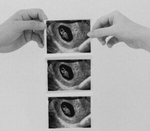 two hands holding a sonogram